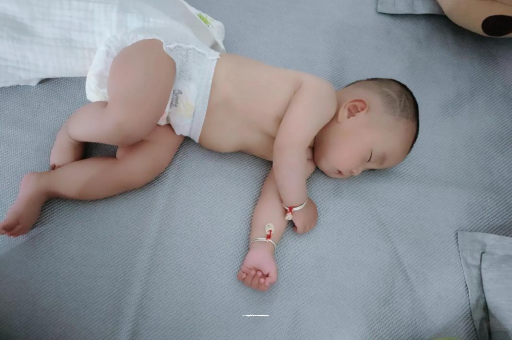 石狮六个月宝宝眼睛散光
